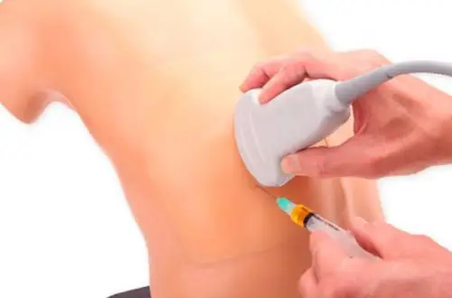 Toracoscentésis diagnóstica